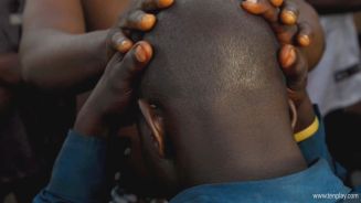 Aberglaube: Jagd auf Männer mit Glatze in Mosambik